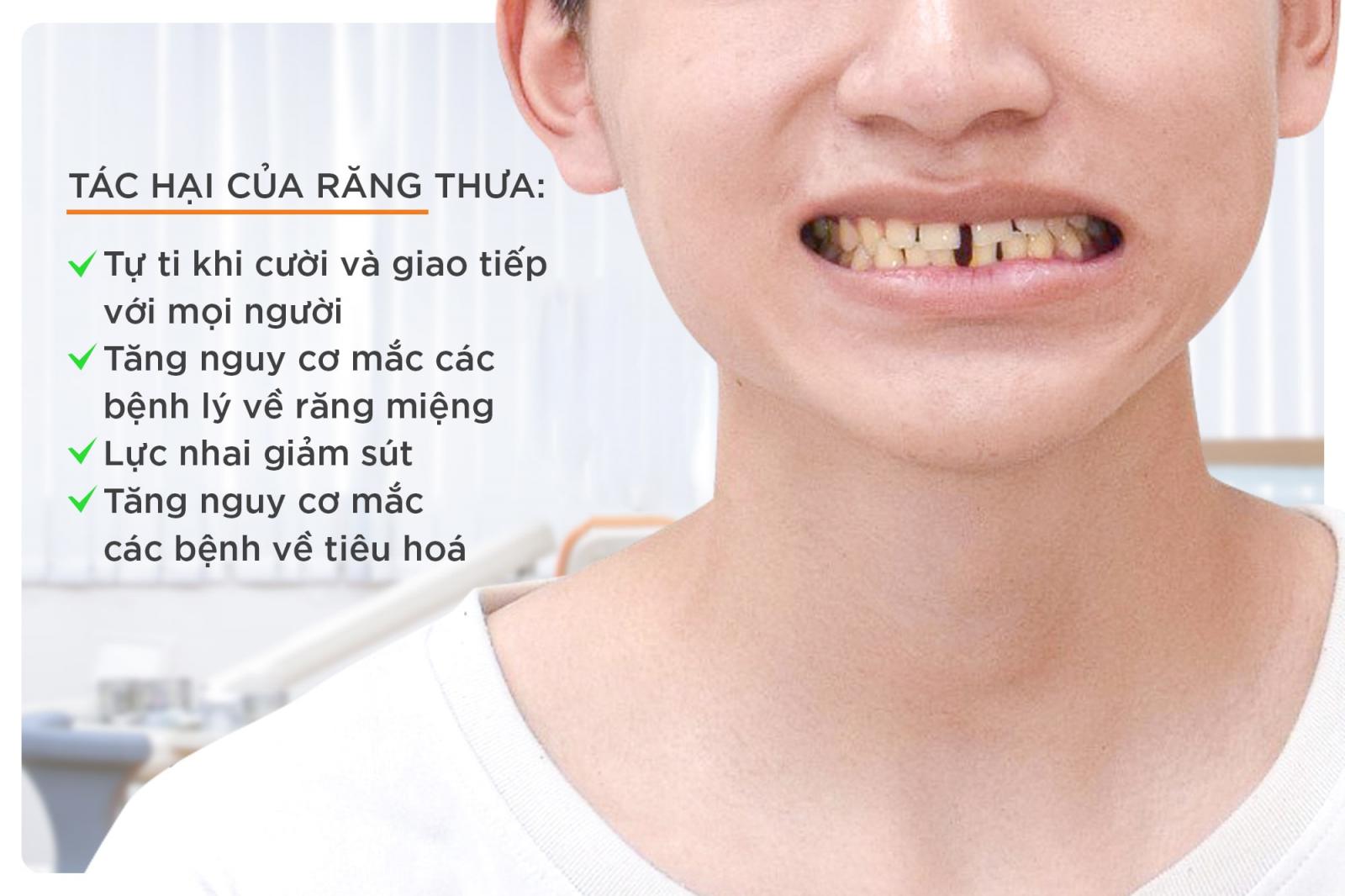 tác hại của răng thưa