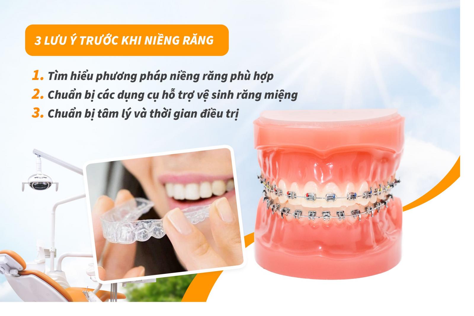 03 lưu ý trước khi niềng răng