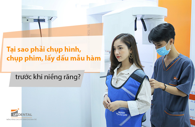 Tại sao phải chụp X-quang trước khi niềng