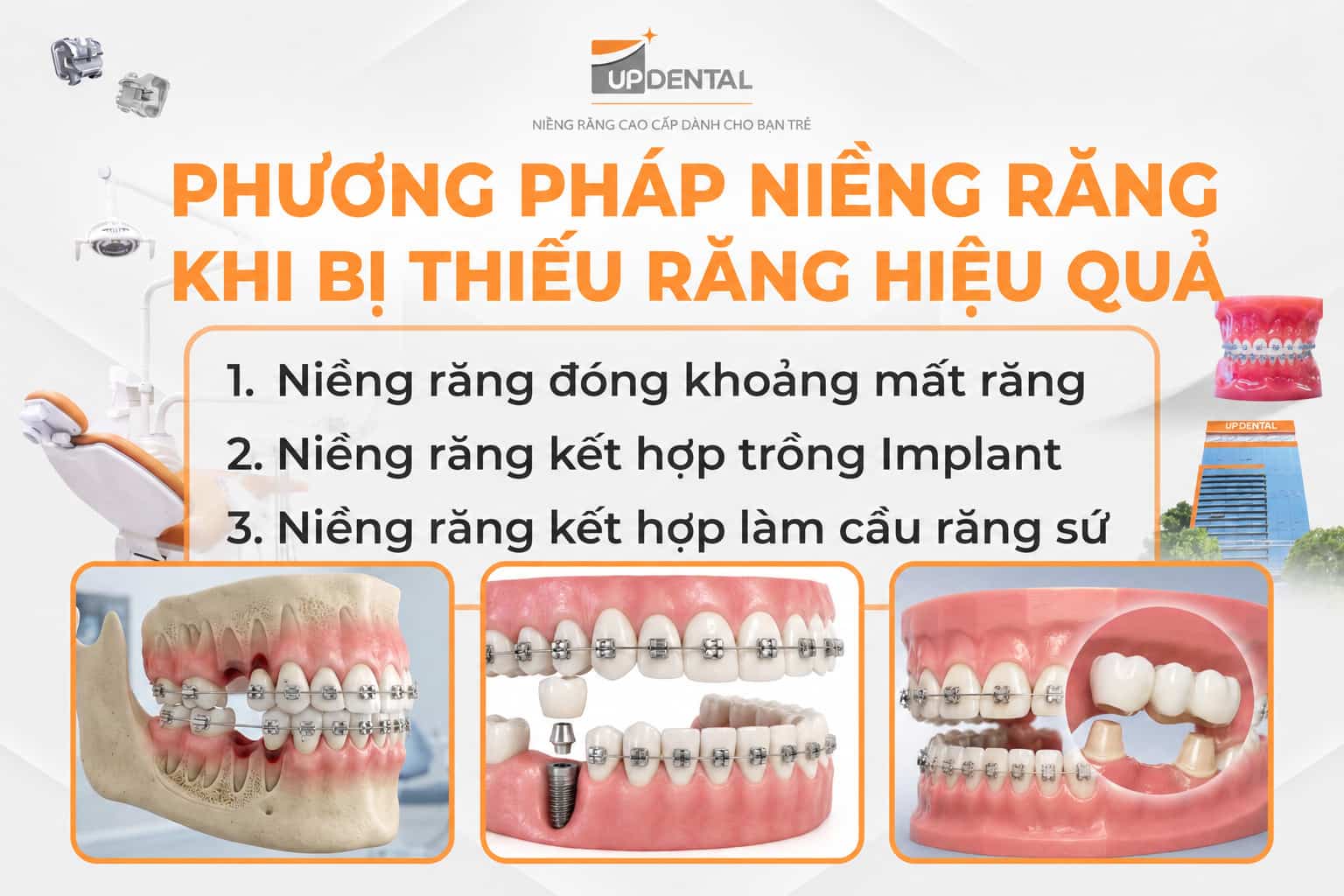 Phương pháp niềng răng khi bị thiếu răng hiệu quả