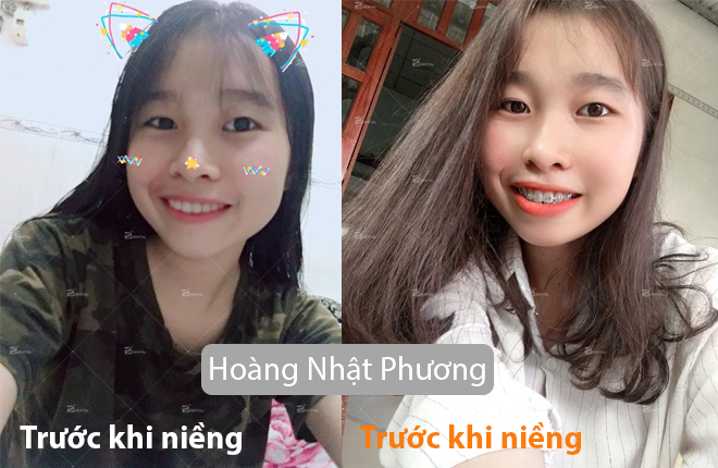 nhat-ky-nieng-rang
