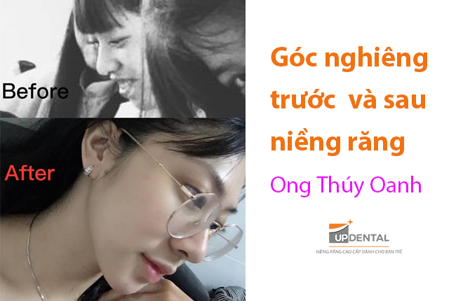 nhat-ky-nieng-rang