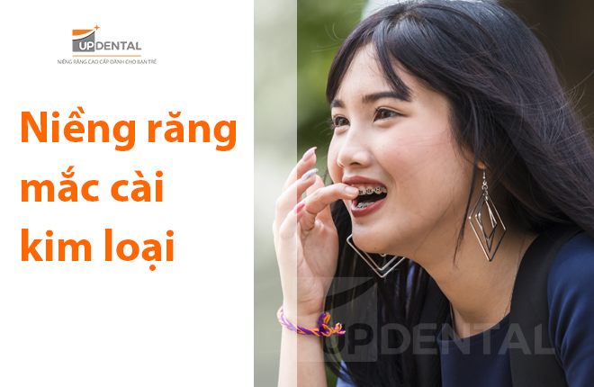 nieng rang mac cai kim loai