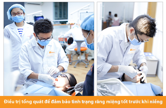 quy-trinh-nieng-rang