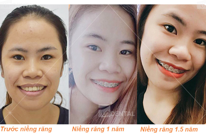 hinh anh ket qua nieng rang