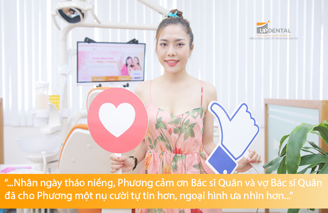 Niềng răng đau hay không đau khách hàng Bích Phương
