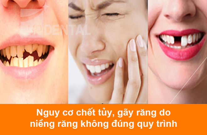 nguy co gay rang som