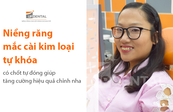 nieng rang mac cai kim loai cao cap tu khoa