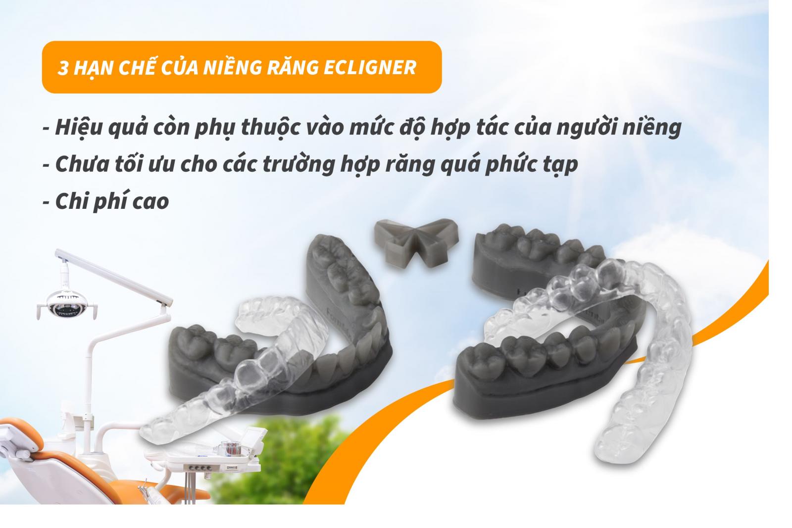 3 hạn chế của niềng răng Ecligner