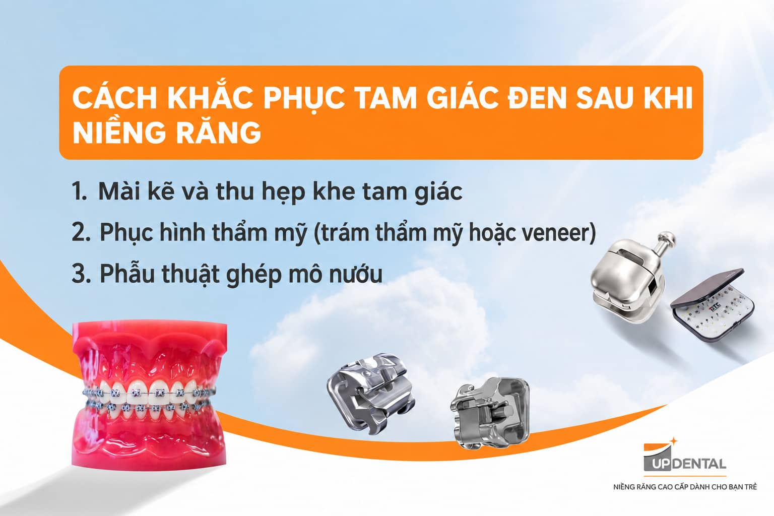 Cách khắc phục tam giác đen sau khi niềng răng