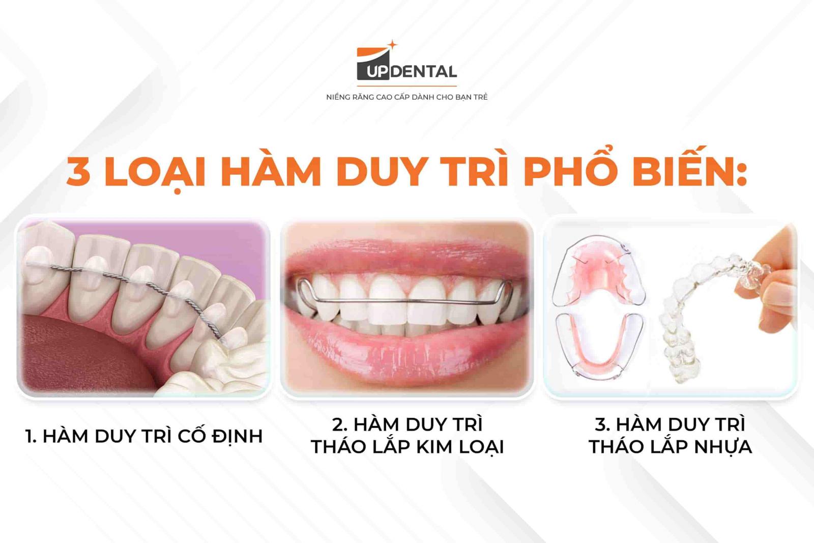 3 loại hàm duy trì sau niềng răng hiện nay