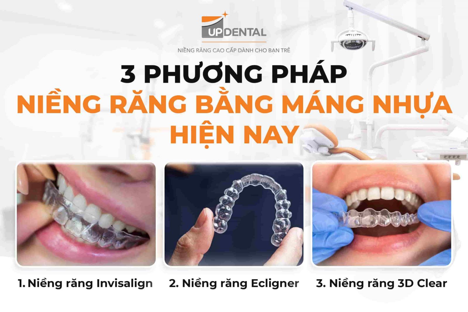 3 phương pháp niềng răng bằng máng nhựa hiện nay