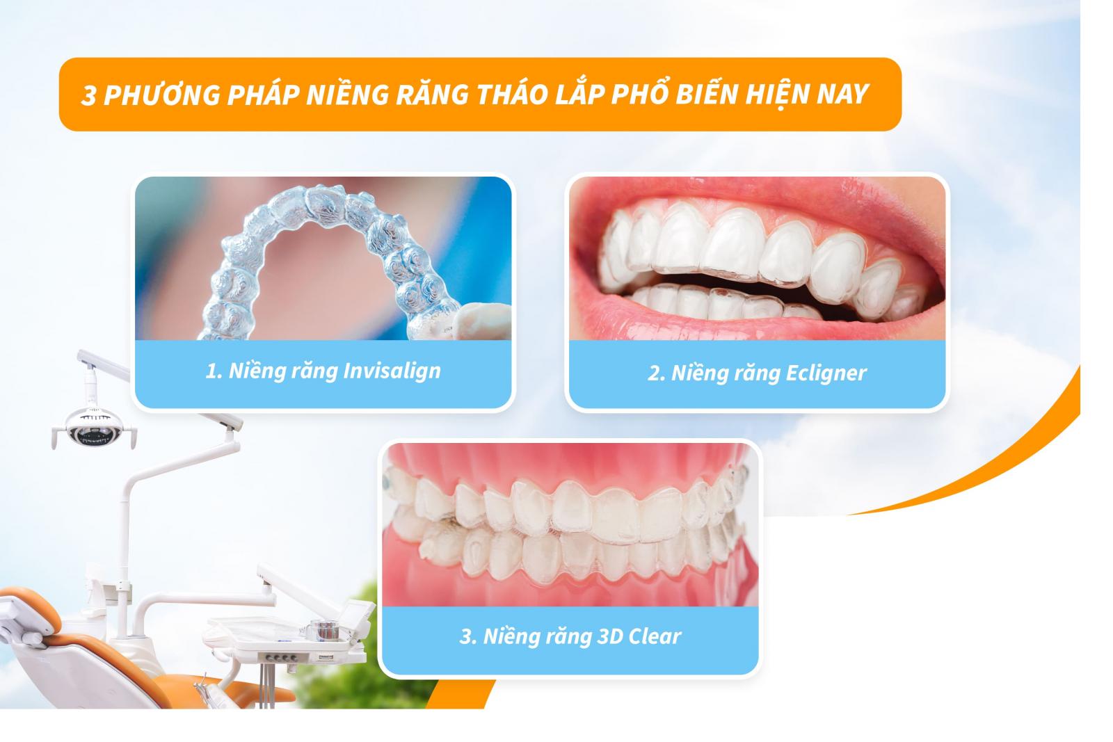 3 phương pháp niềng răng tháo lắp phổ biến hiện nay