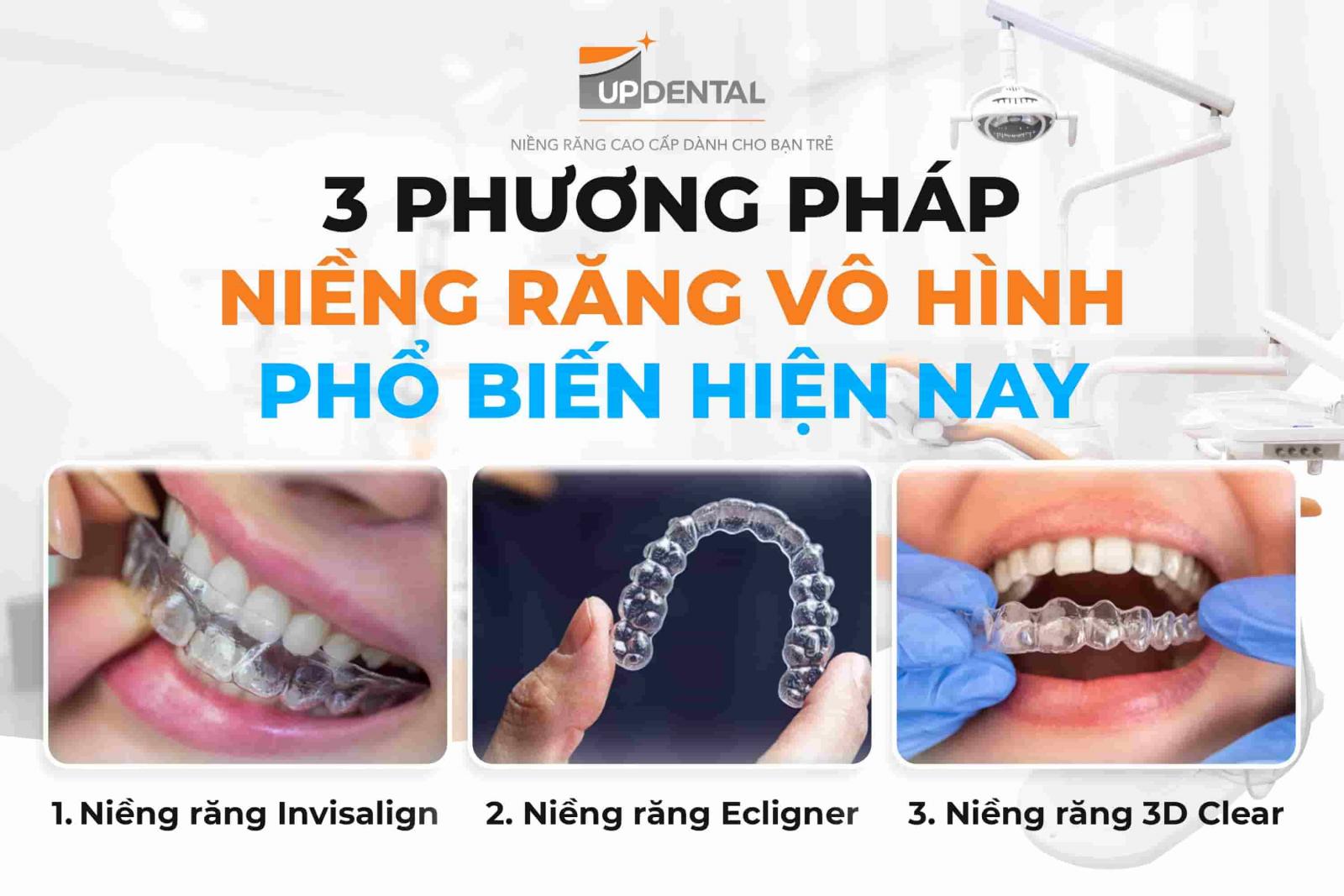 3 phương pháp niềng răng vô hình phổ biến hiện nay