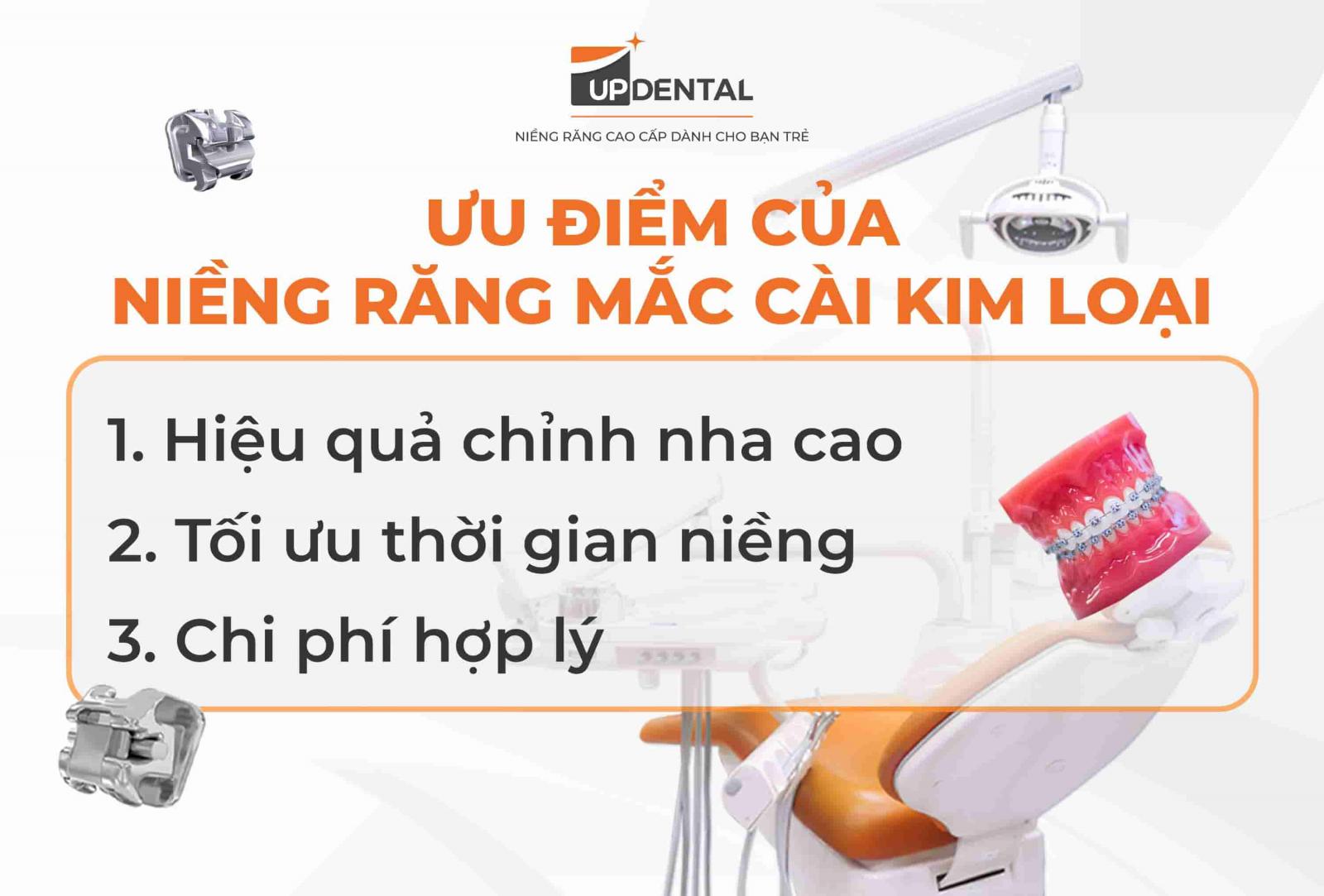 Ưu điểm của niềng răng mắc cài kim loại