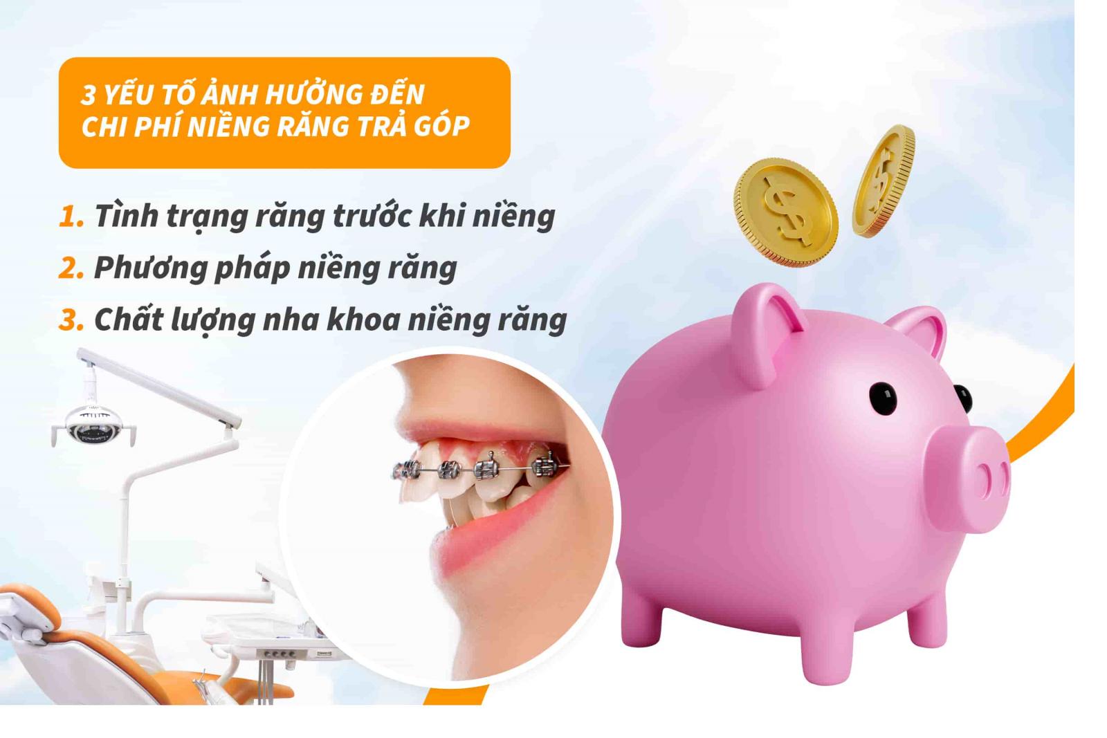 3 yếu tố ảnh hưởng đến chi phí niềng răng trả góp