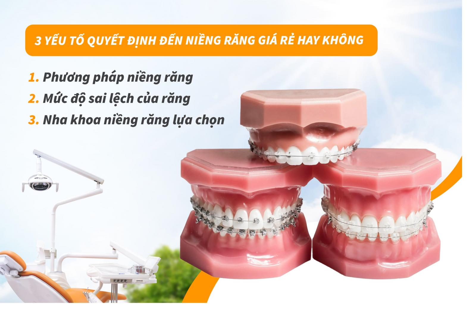 3 yếu tố ảnh hưởng đến niềng răng giá rẻ hay không