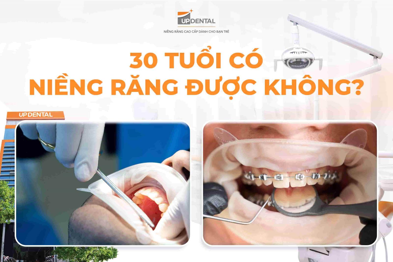 30 tuổi có niềng răng được không?
