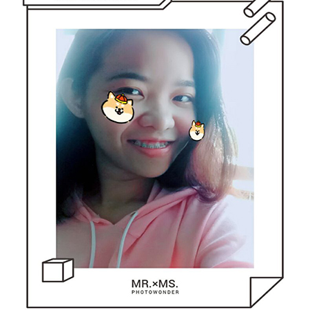 Review hinh anh hieu qua nieng rang tai nha khoa Up dental