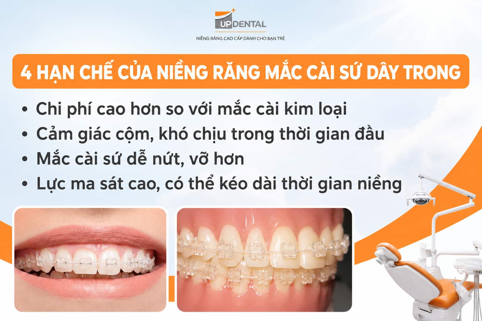 4 hạn chế của niềng răng mắc cài sứ dây trong