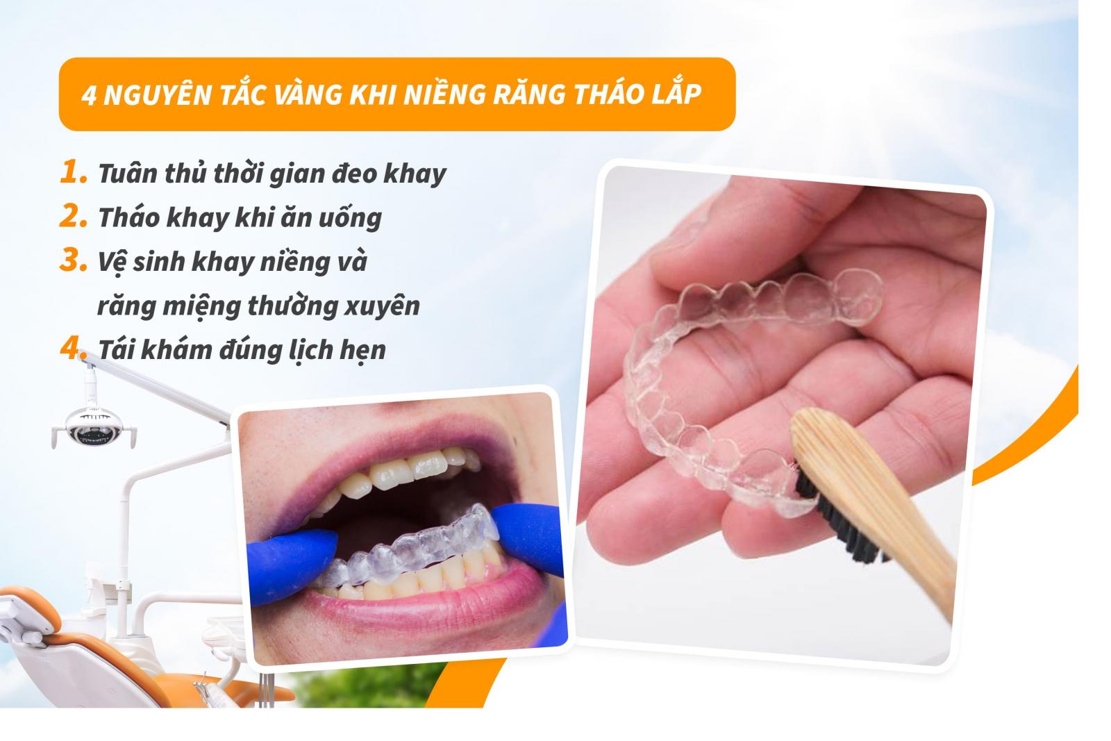 4 nguyên tắc vàng khi niềng răng tháo lắp