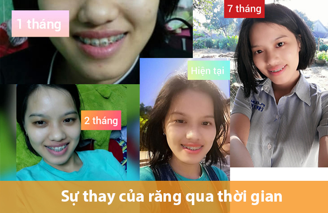 nhat-ky-nieng-rang
