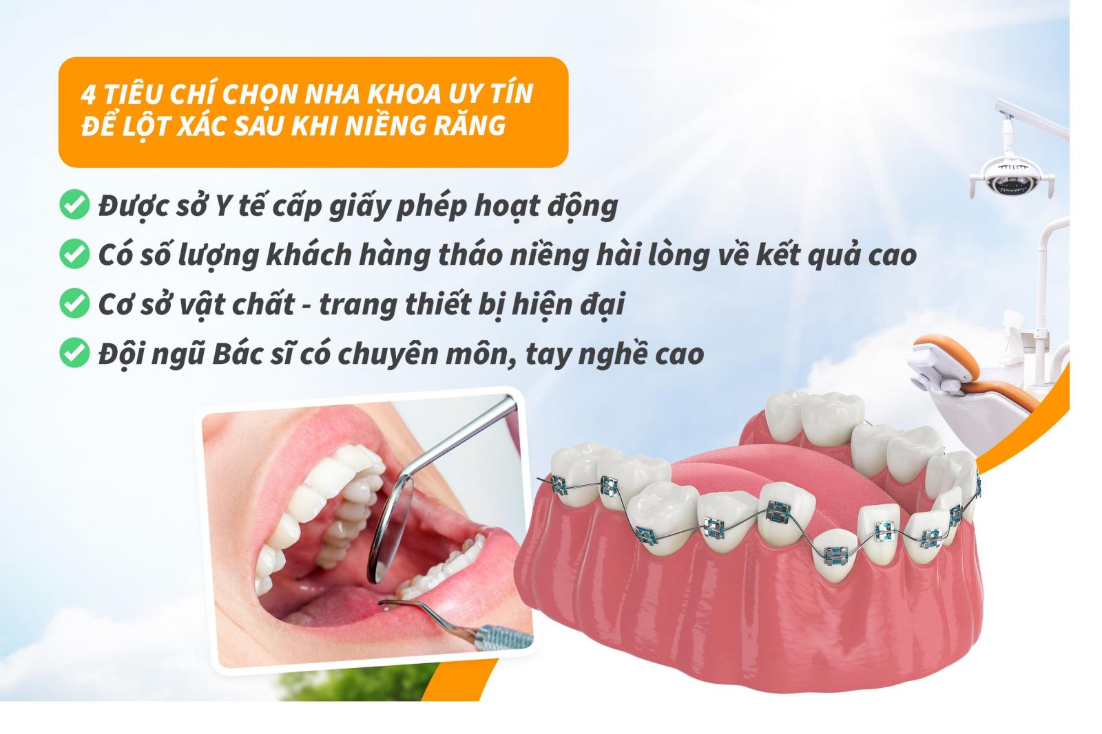4 tiêu chí chọn nha khoa uy tín để lột xác sau khi niềng răng