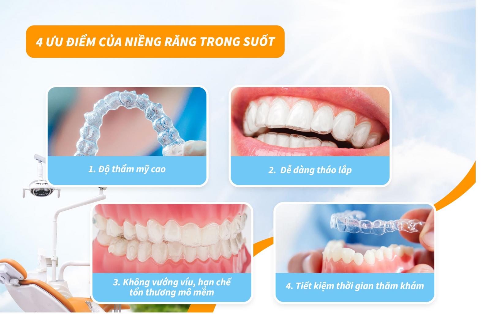 4 ưu điểm của niềng răng trong suốt