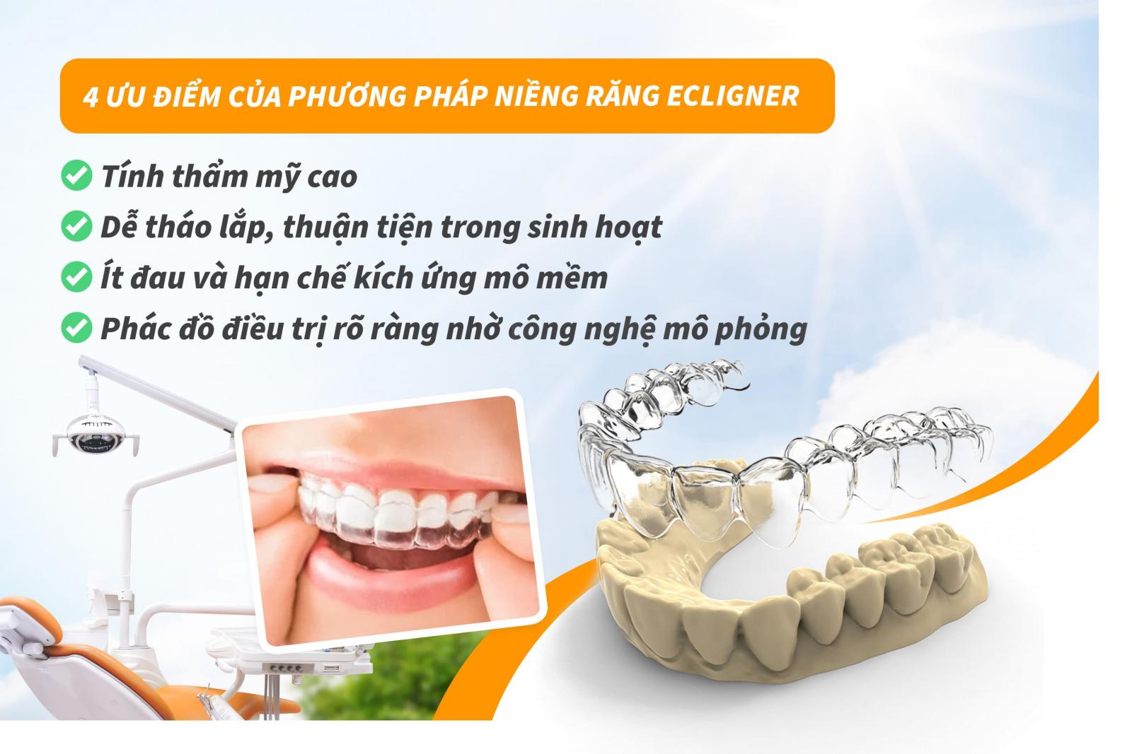 4 ưu điểm của phương pháp niềng răng Ecligner