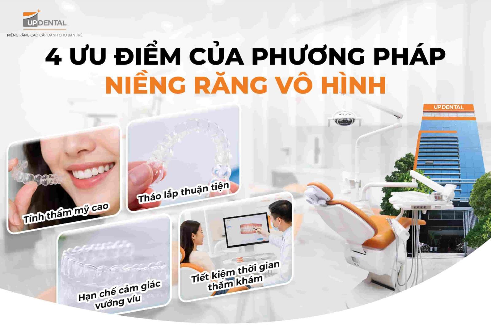 4 ưu điểm của phương pháp niềng răng vô hình