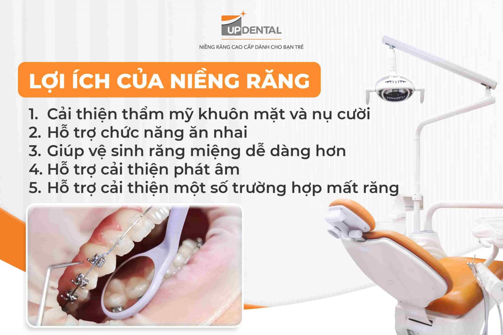 Niềng răng có tốt không