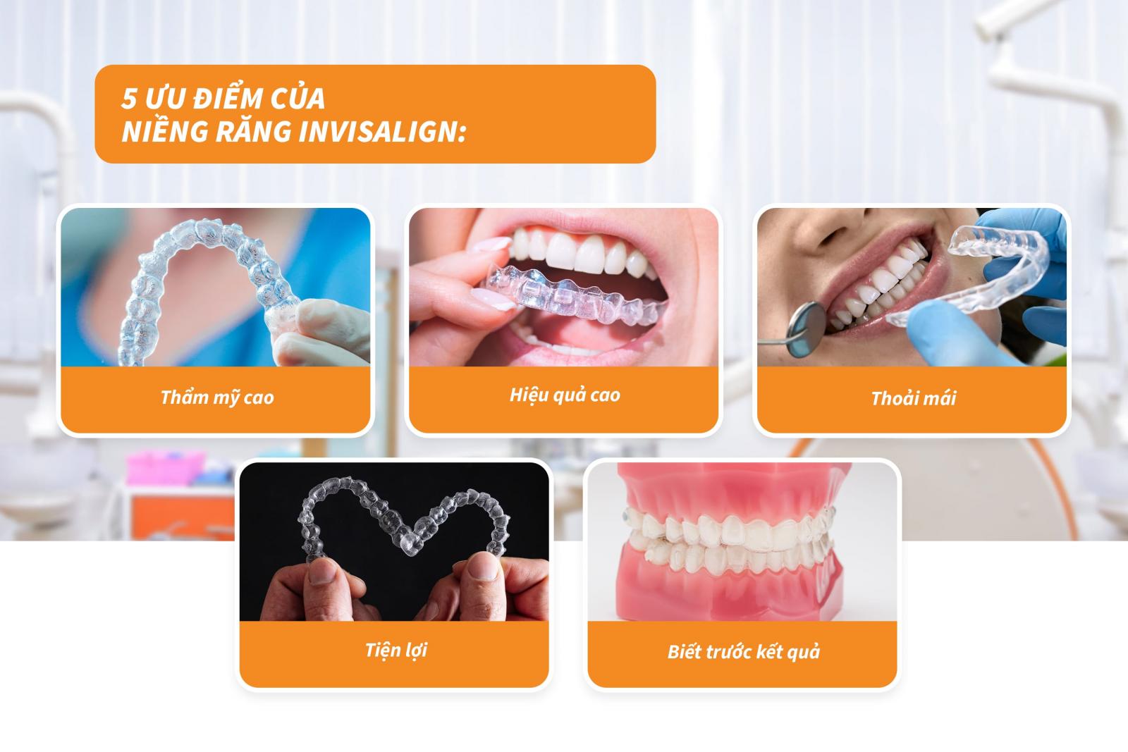 5 ưu điểm của niềng răng Invisalign
