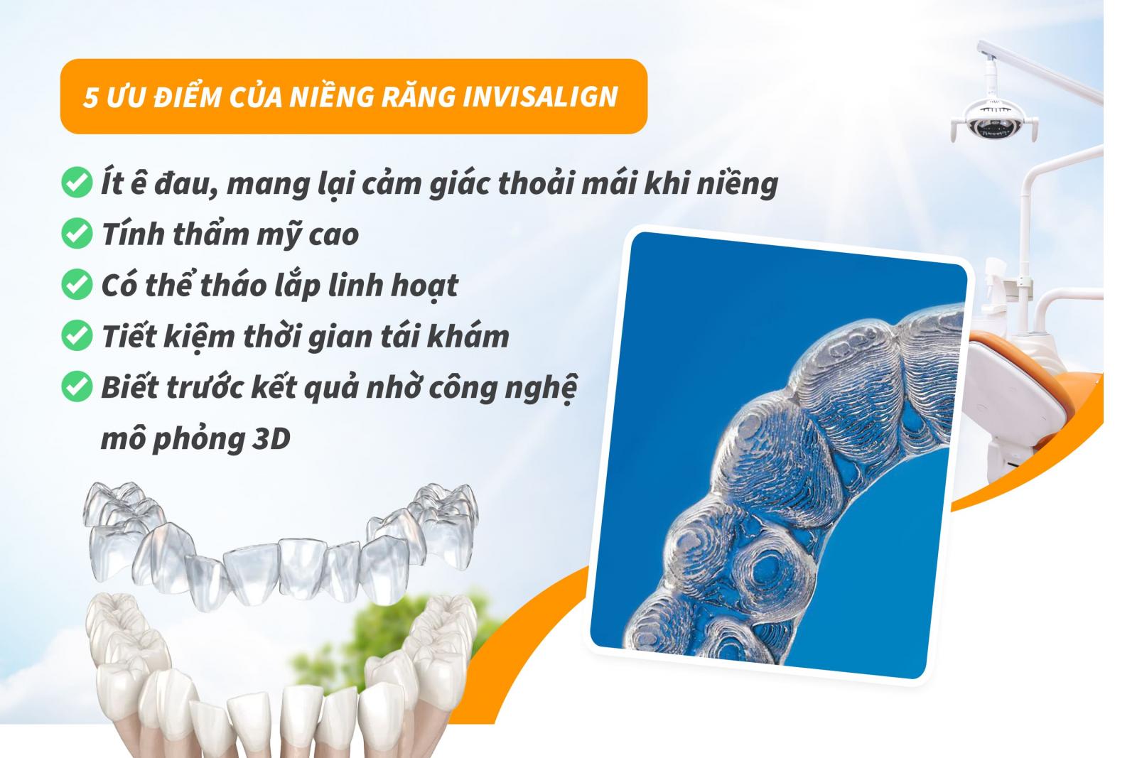 5 ưu điểm của niềng răng Invisalign