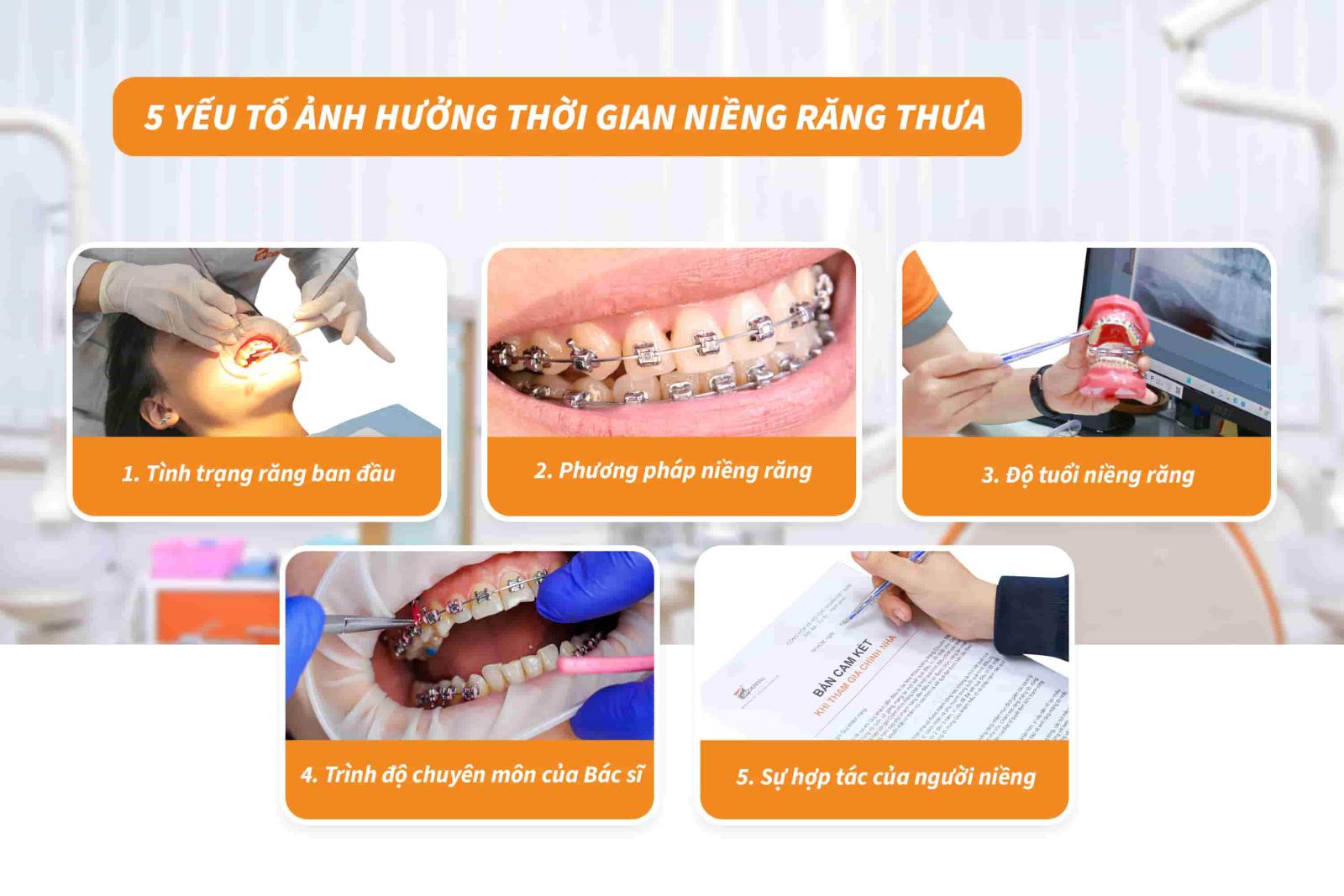 05 yếu tố ảnh hưởng thời gian niềng răng thưa