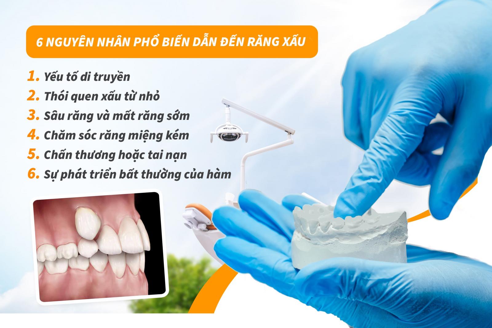 Các nguyên nhân dẫn đến răng xấu