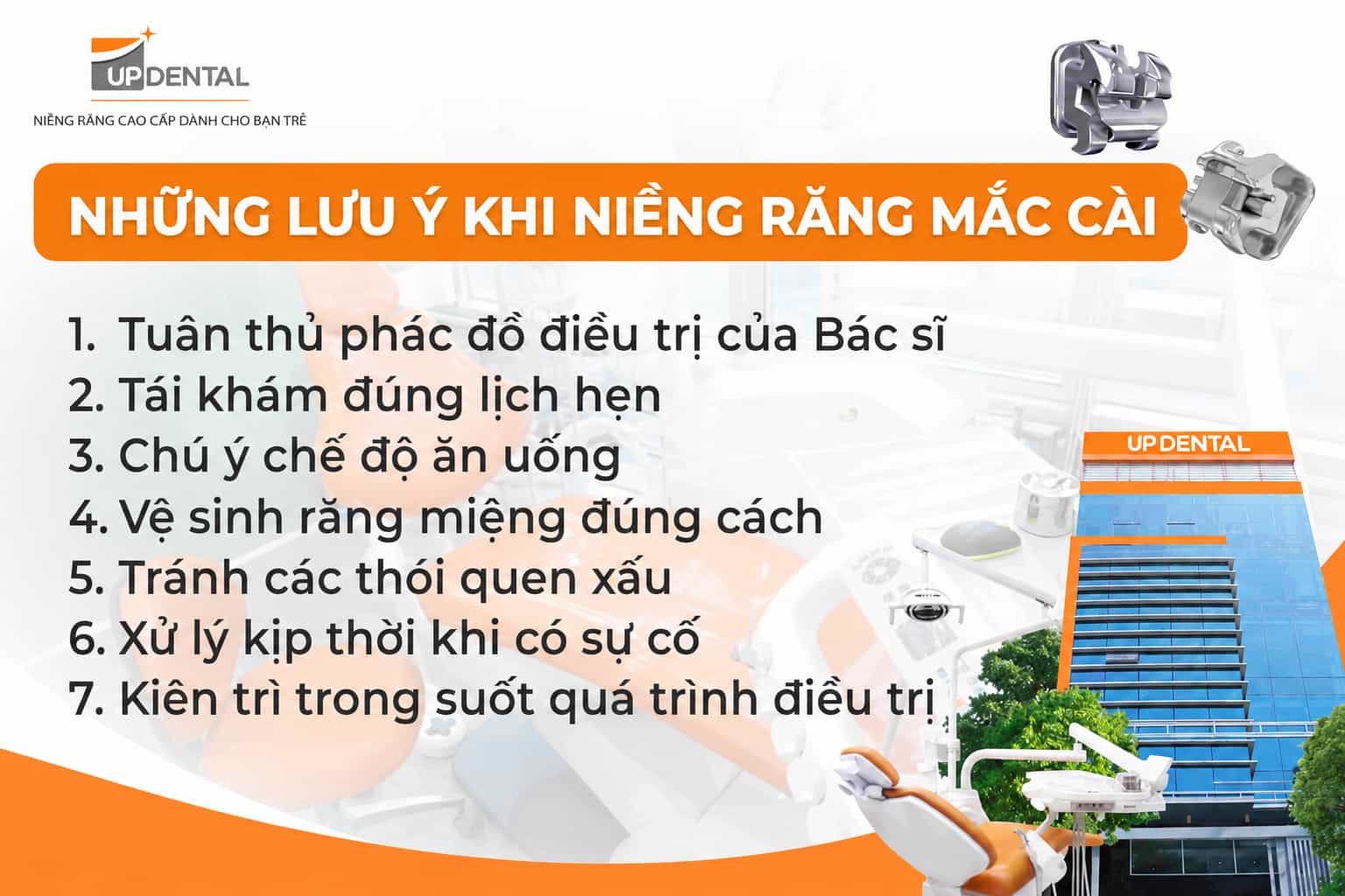 7 lưu ý khi niềng răng mắc cài