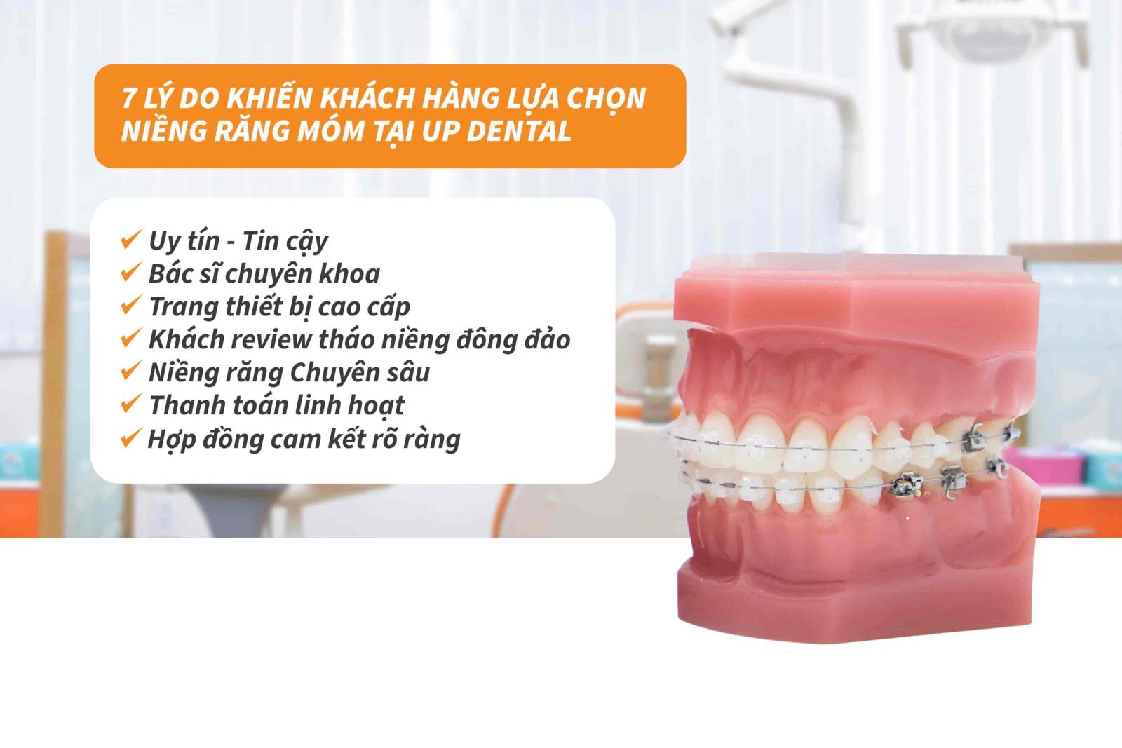 7 lý do khách hàng lựa chọn niềng răng ở Up Dental