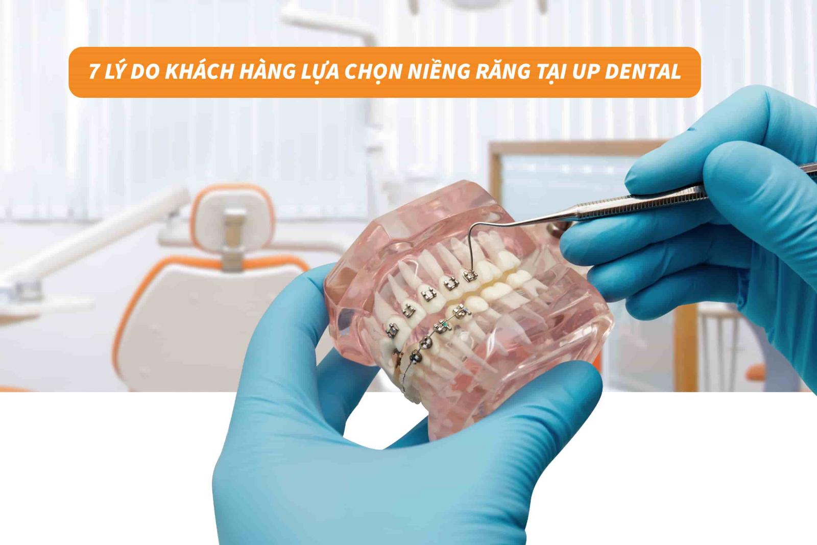 7 lý do khách hàng lựa chọn niềng răng tại Up Dental