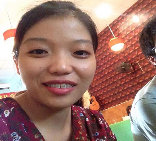 nieng rang so huu nu cuoi tu tin rang ro