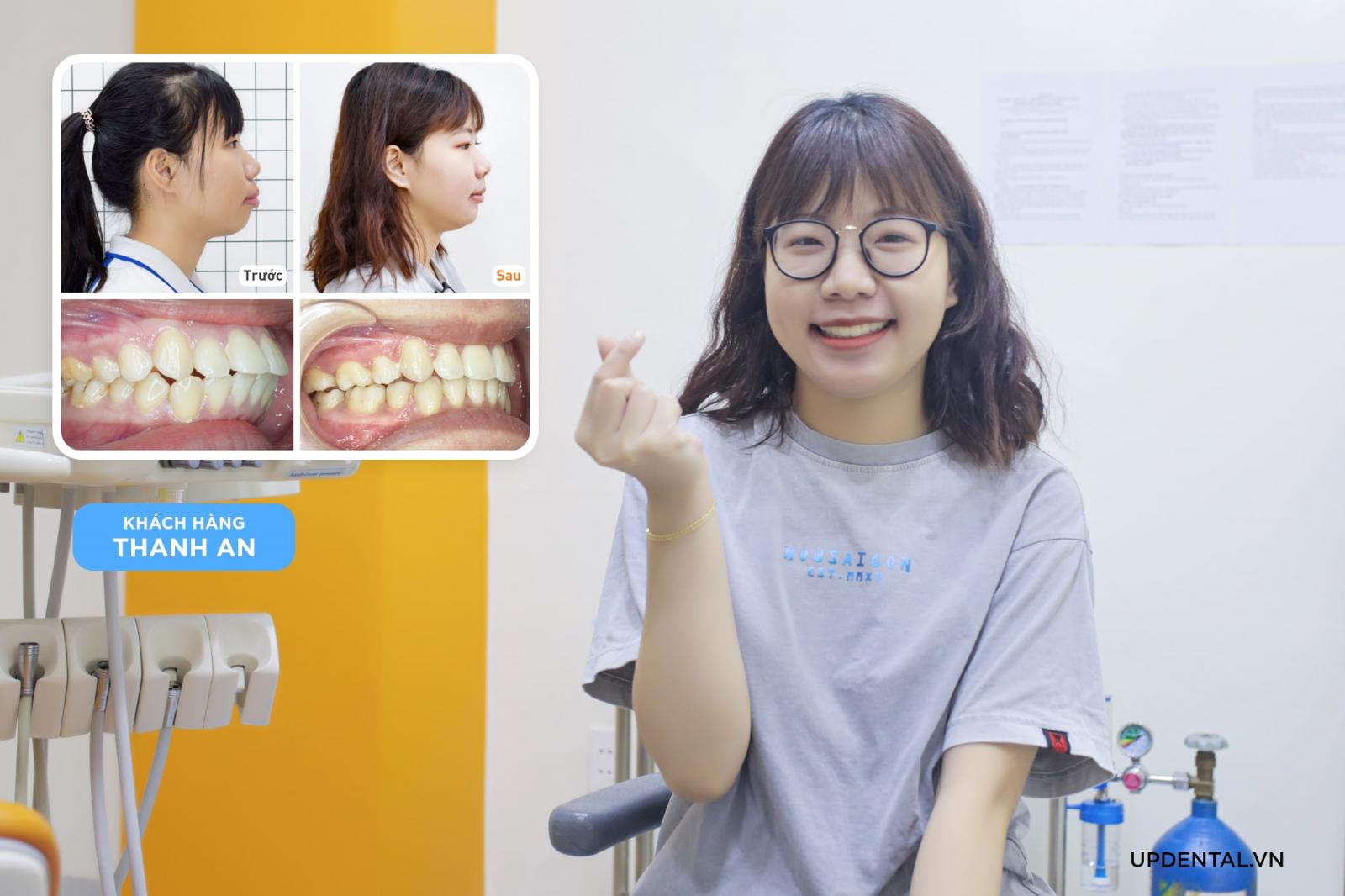 khach-hang-thay-doi-sau-nieng-tai-up-dental