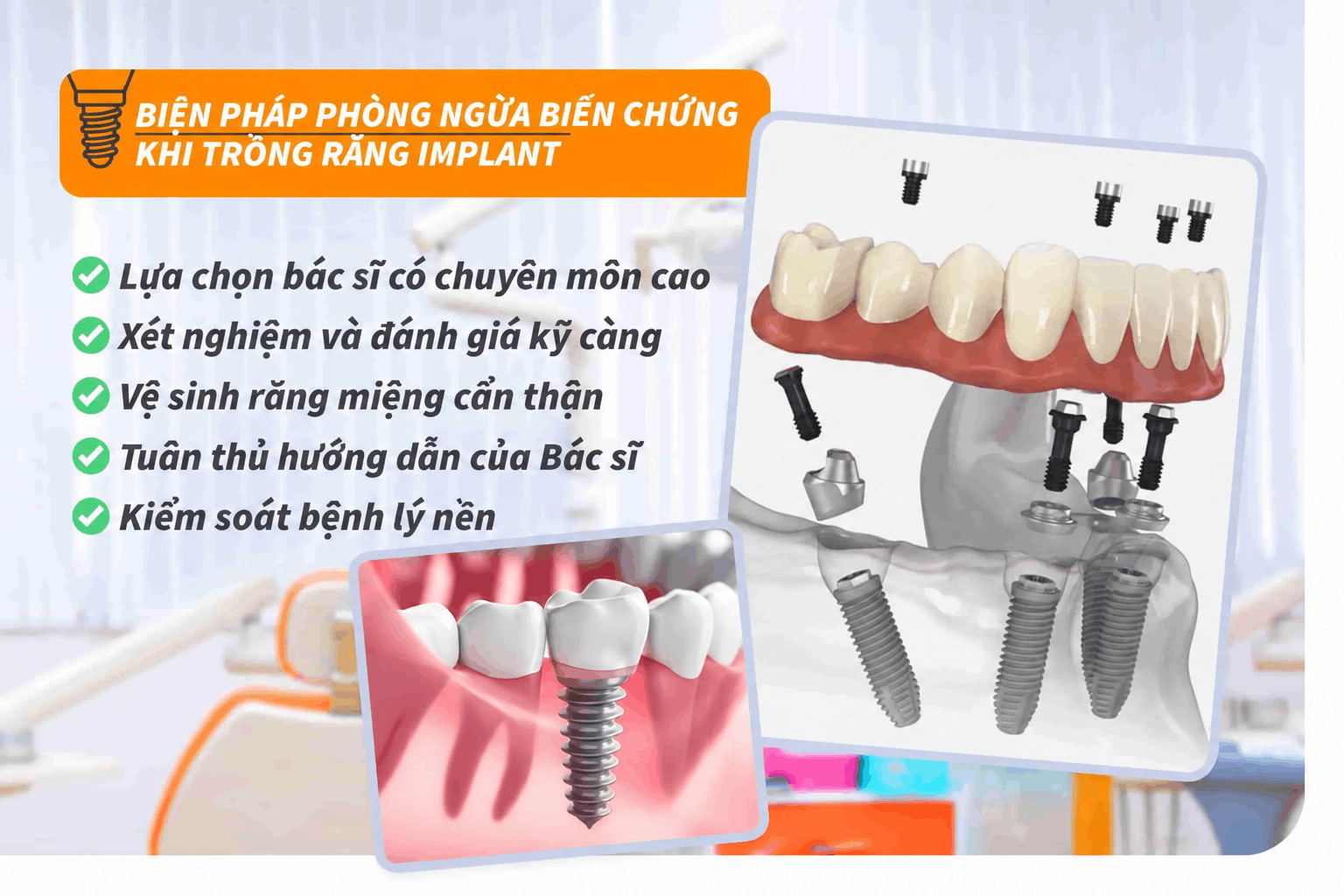 Biện pháp phòng ngừa biến chứng khi trồng răng Implant