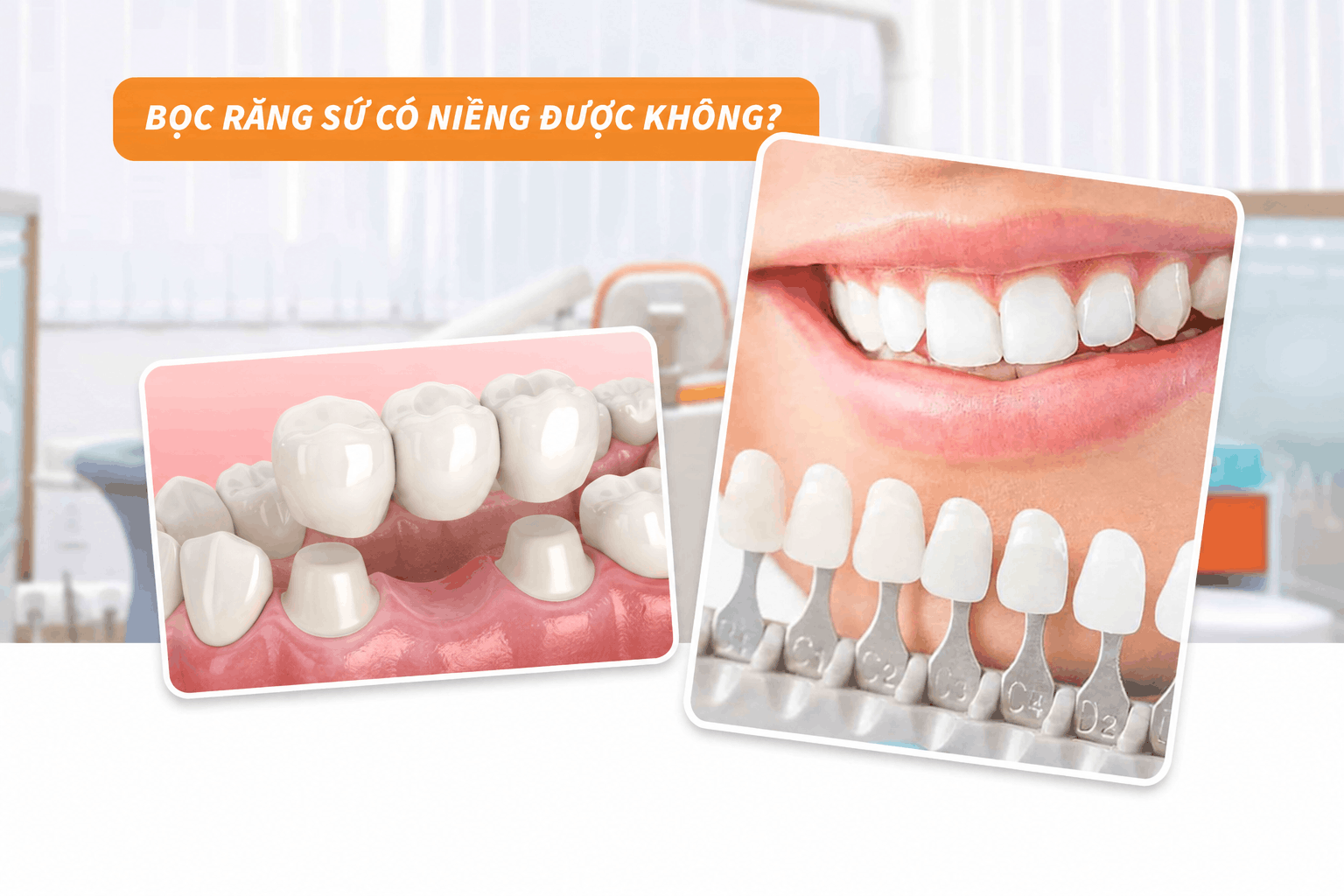 Bọc răng sứ có niềng được không?