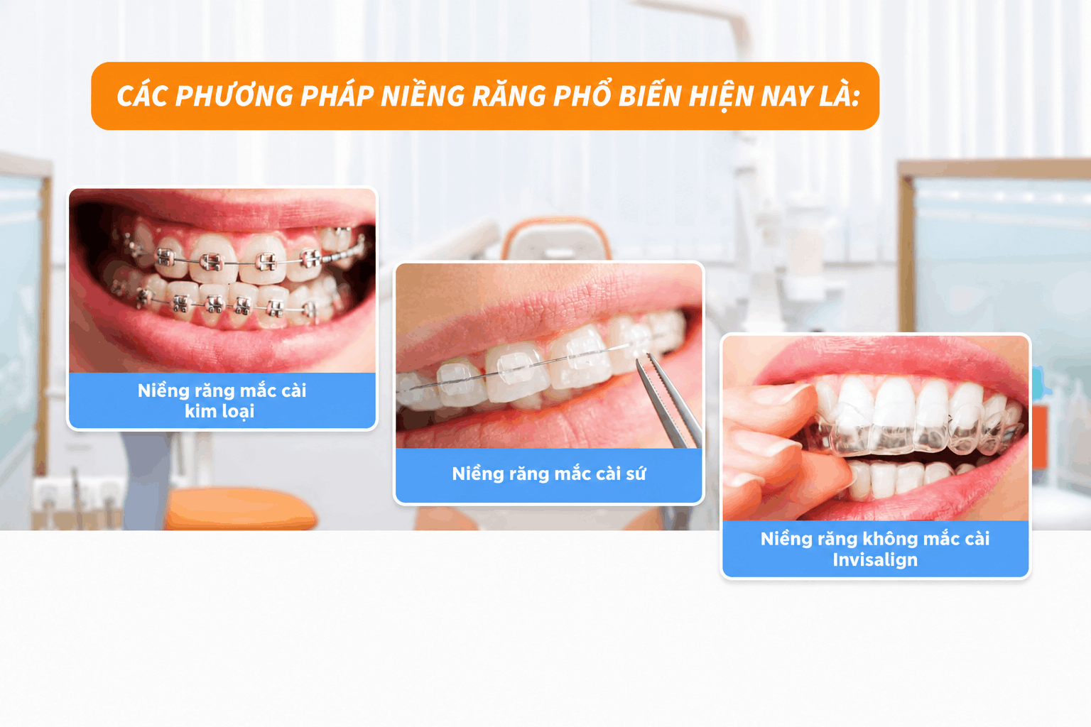 Các phương pháp niềng răng phổ biến hiện nay