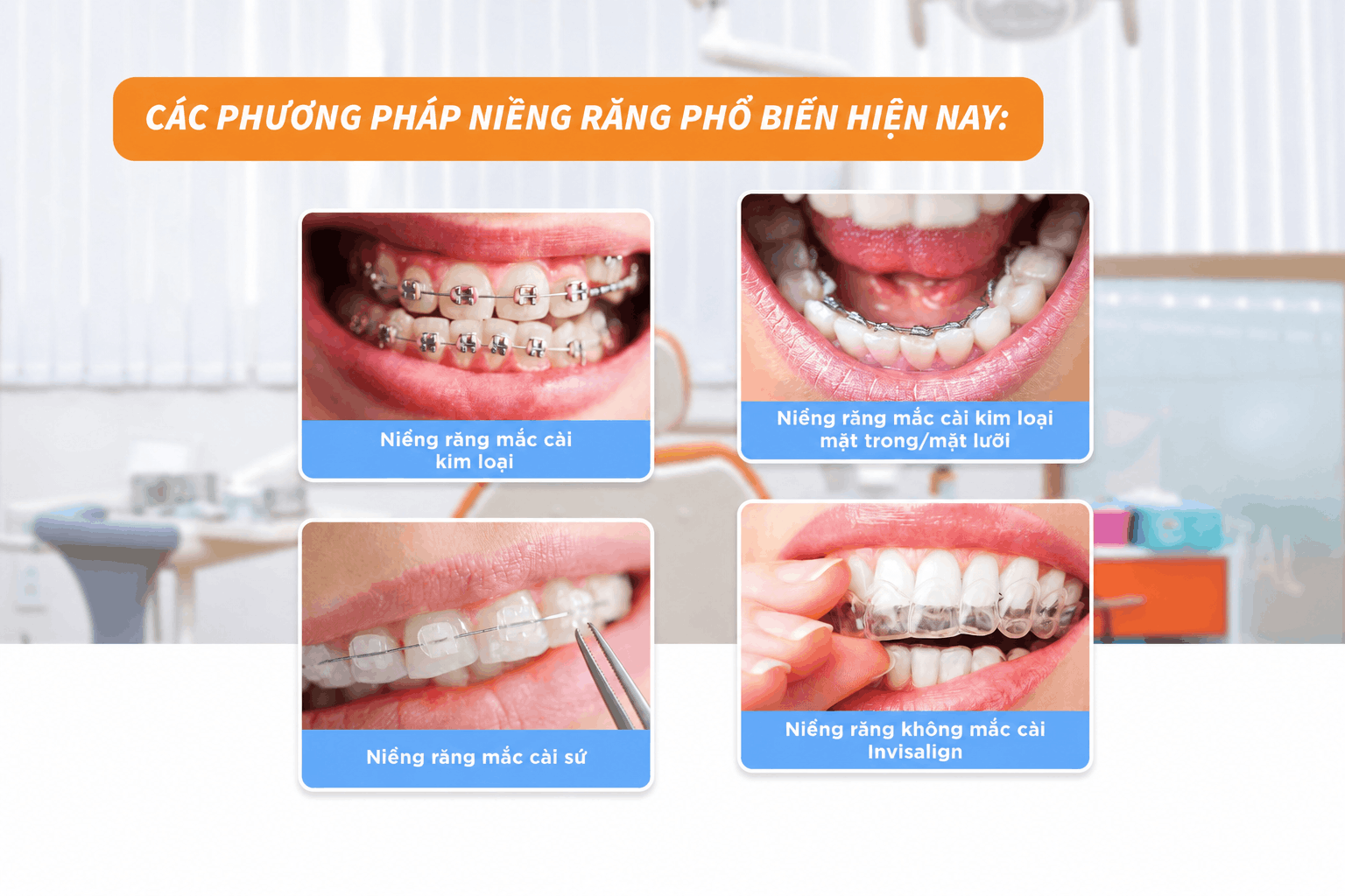 Các phương pháp niềng răng cải thiện lệch mặt hiện nay