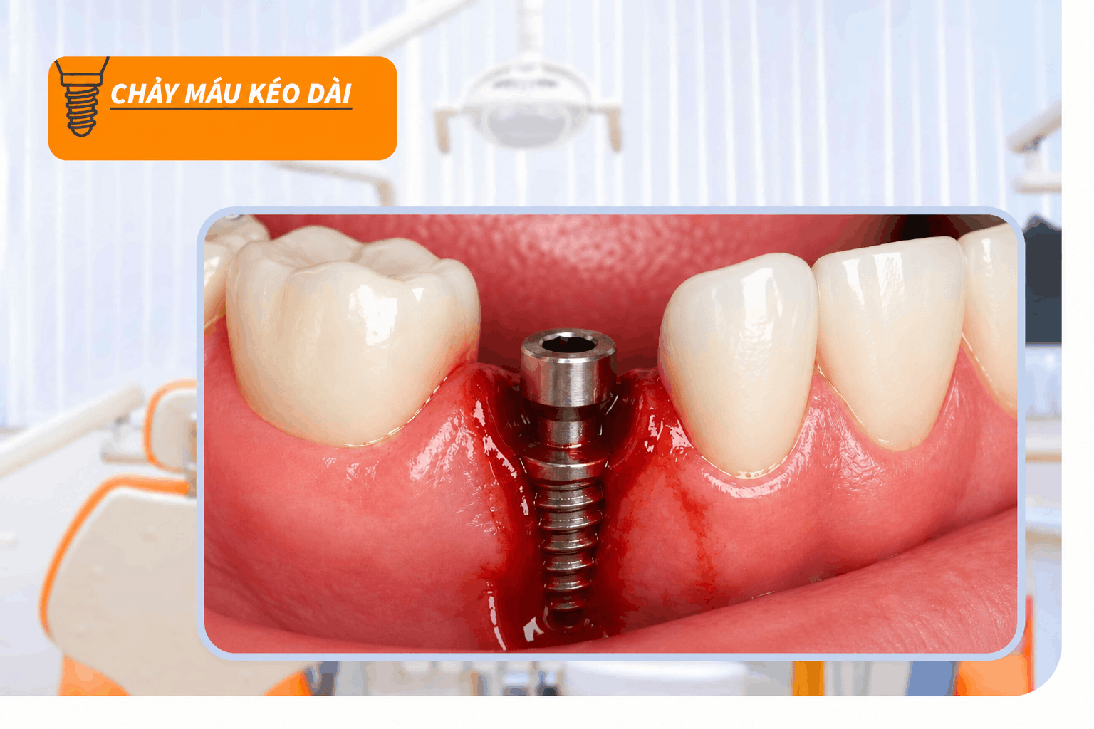 Chảy máu kéo dài