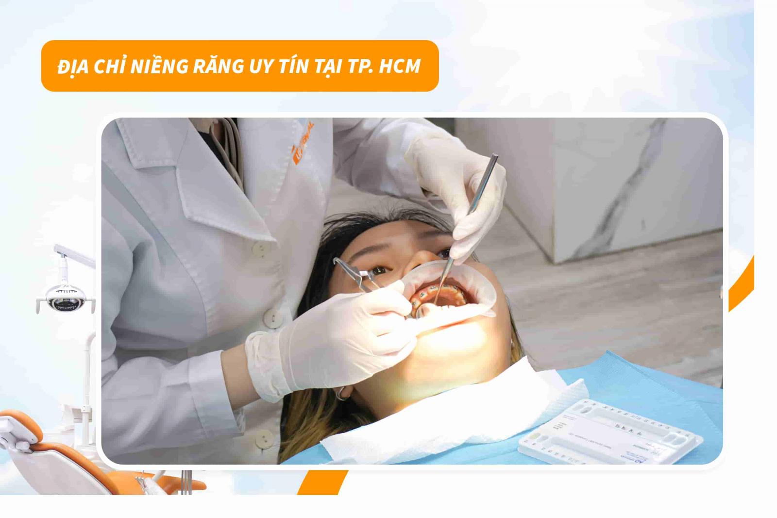 Địa chỉ niềng răng uy tín tại TP.HCM