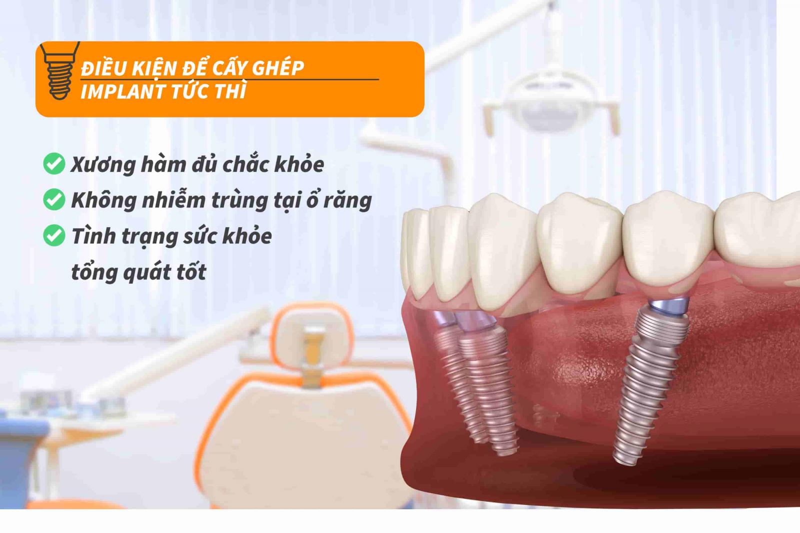 Điều kiện để cấy ghép Implant tức thì