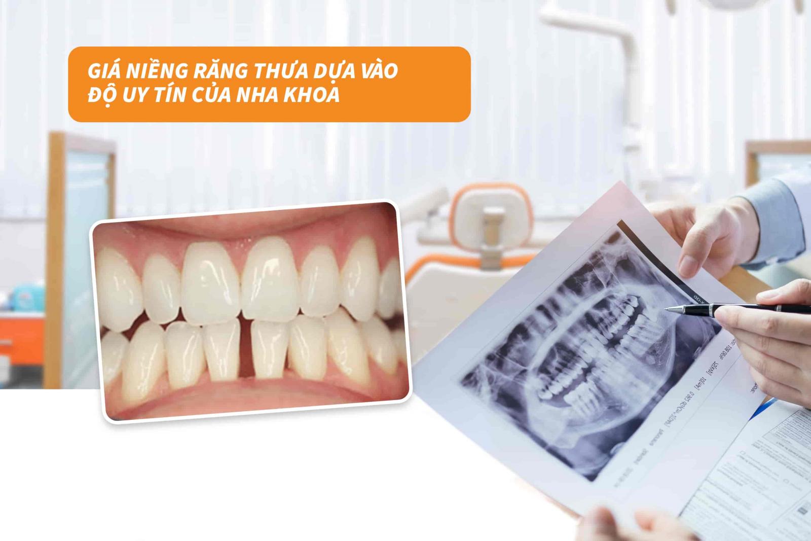 Giá niềng răng dựa vào độ uy tín của nha khoa
