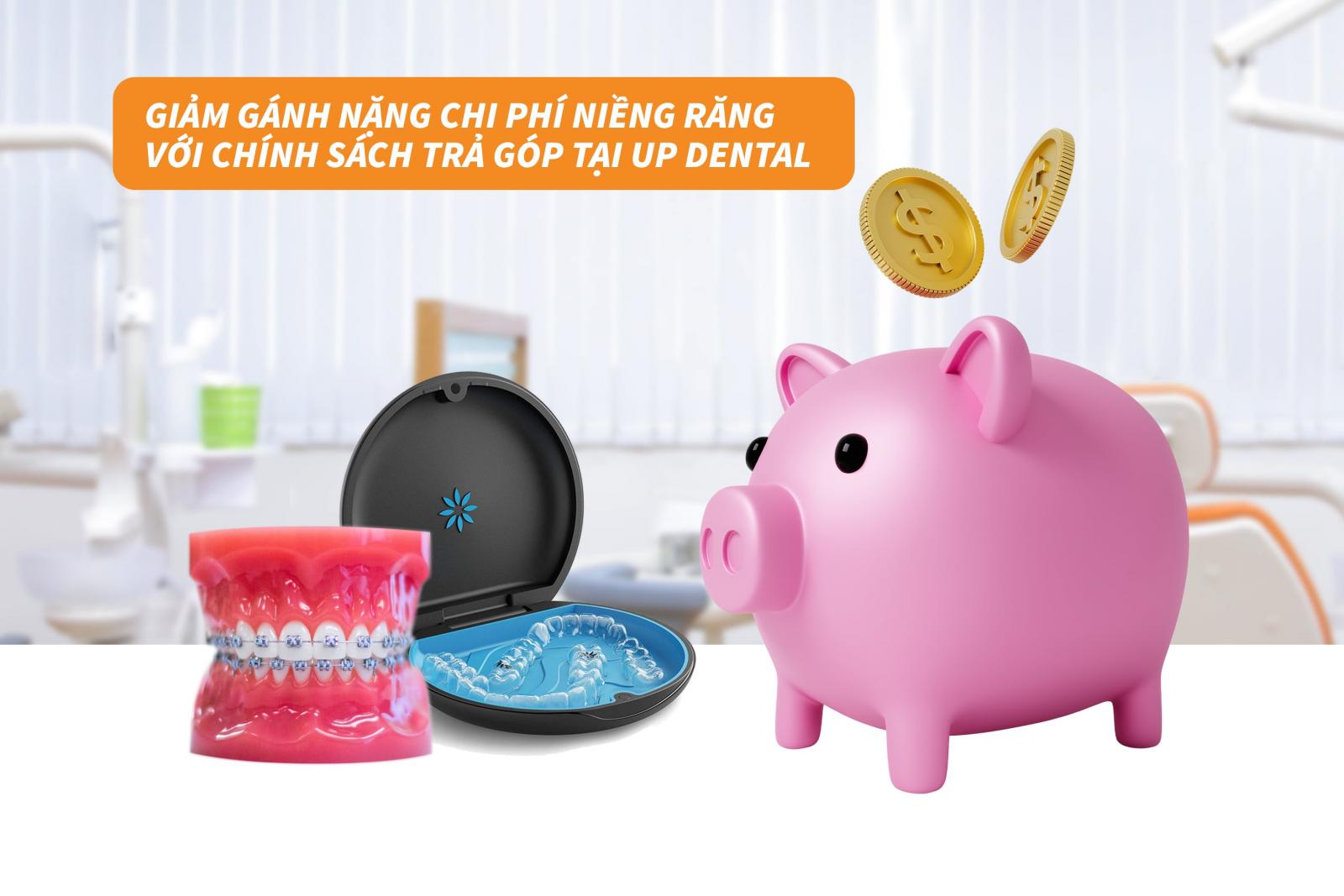 Giảm gánh nặng chi phí niềng răng với chính sách trả góp tại Up Dental 