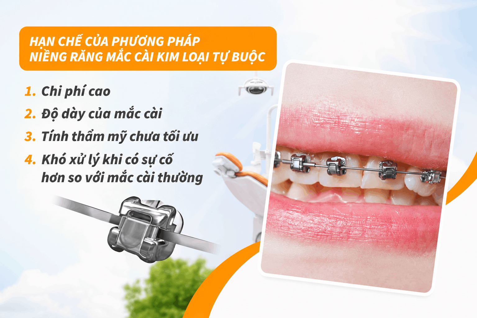 Hạn chế của phương pháp niềng răng mắc cài kim loại tự buộc